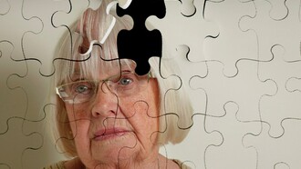 Una mujer a la que le falta una pieza en su cabeza