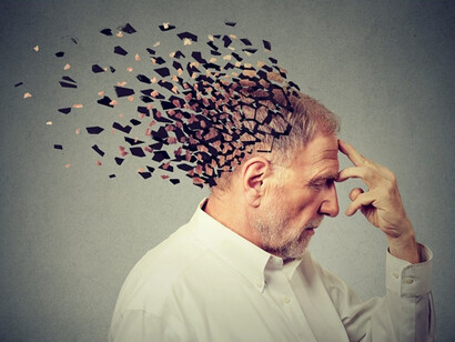 Si stima che in Italia vi siano circa 1.000.000 di persone affette dalla malattia di Alzheimer