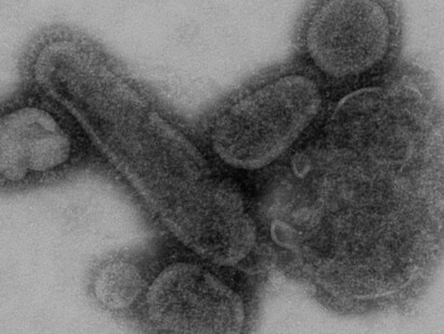 Reconstrucción del virus de la gripe española 