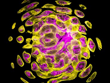 These findings demonstrate that moderate physical exercise empowers immune cells to clear potential threats and prevent breast cancer