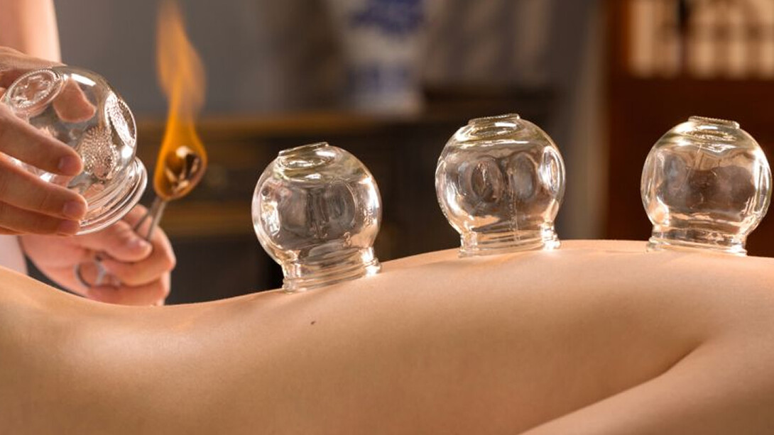 Cupping therapy
