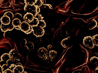 Lo que el microscopio muestra