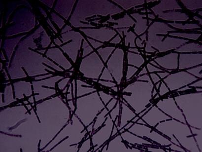 Fotomicrografía de una tinción de Gram de la bacteria «Bacillus anthracis»