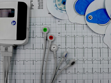 Detailed ECG leads shown on a heart monitor printout, illustrating heart disease diagnosis and prevention