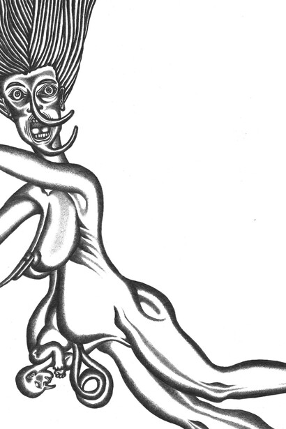 Caesarean birth