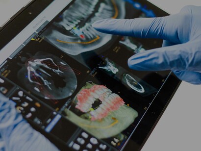 X-rays showing the problem areas are the best way for people in the field of dentistry to know where and what to fix