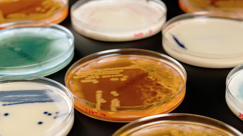 Superbugs. Courtesy of Science Museum