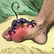 James Gillray (1757‒1815), The Gout, 1799, Hand-coloured soft ground etching, 26 x 35.5 cm © Courtesy of the Warden and Scholars of New College, Oxford / Bridgeman Images