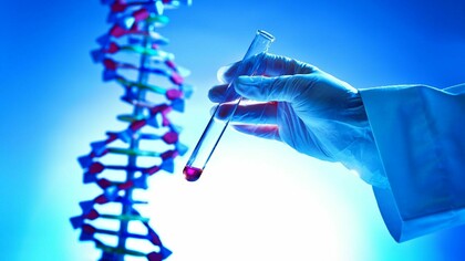 DNA text: DNA ancestry test may include an ethnic assessment or evaluation