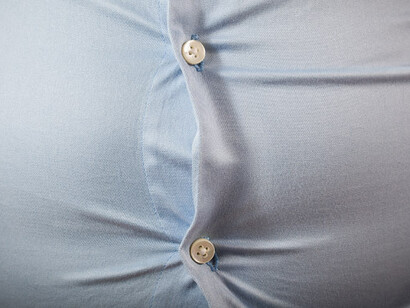 The energy imbalance between calories consumed and calories expended is the basic cause of obesity