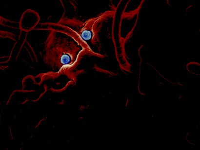 Imagen microscópica electrónica de barrido digitalizada (SEM) muestra dos formas virales  del coronavirus del síndrome respiratorio (MERS-CoV), de color azul, que estaban en la superficie de una célula epitelial de camello, de color rojo