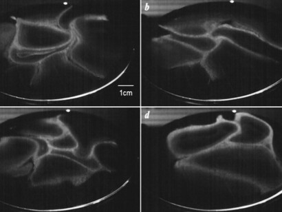 Cross-sections of rising vapor are imaged just above warm water. Bright areas contain vapor