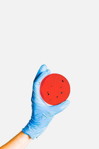 Bactérie Escherichia coli. Lorsqu’on la nourrit de lactose, celui-ci est hydrolysé dans la cellule grâce à une enzyme nommée bêta-galactosidase