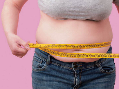 Mujer con obesidad: 650 millones de personas sufren obesidad en el mundo