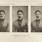Three photos in a series showing Early animated picture by John Arthur Roebuck Rudge depicting the face of William Friese-G a hysterical woman yawning