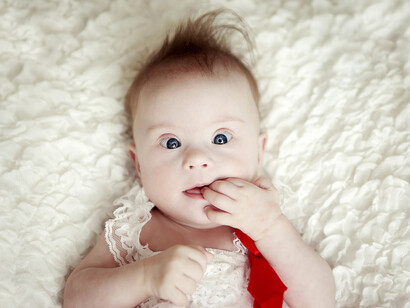 Bebé con síndrome de Down