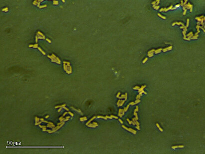 Bactéries. Lorsqu’on change la source de nourriture d’une bactérie, apparaissent dans les cellules les enzymes nécessaires à l’utilisation du nouveau nutriment, c'est ce qu'on appelle l'adaptation enzymatique.