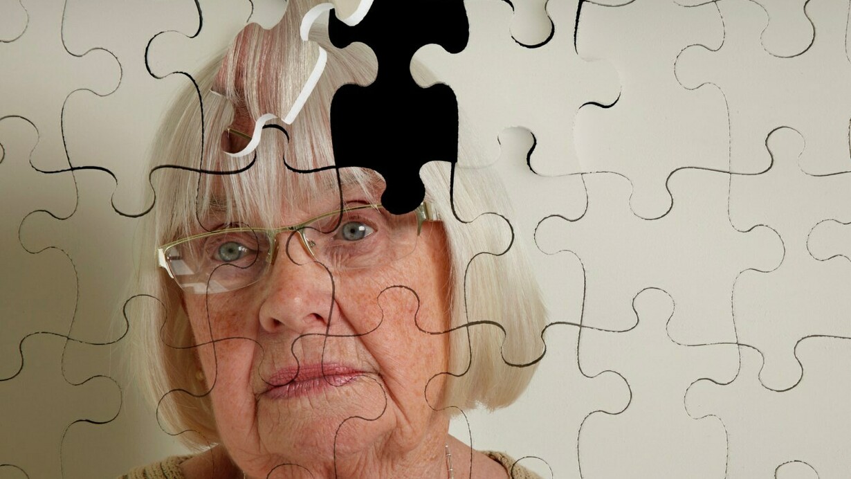 Una mujer a la que le falta una pieza en su cabeza