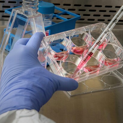 I POCT permettono di eseguire esami diagnostici direttamente vicino al paziente, riducendo i tempi rispetto al laboratorio tradizionale