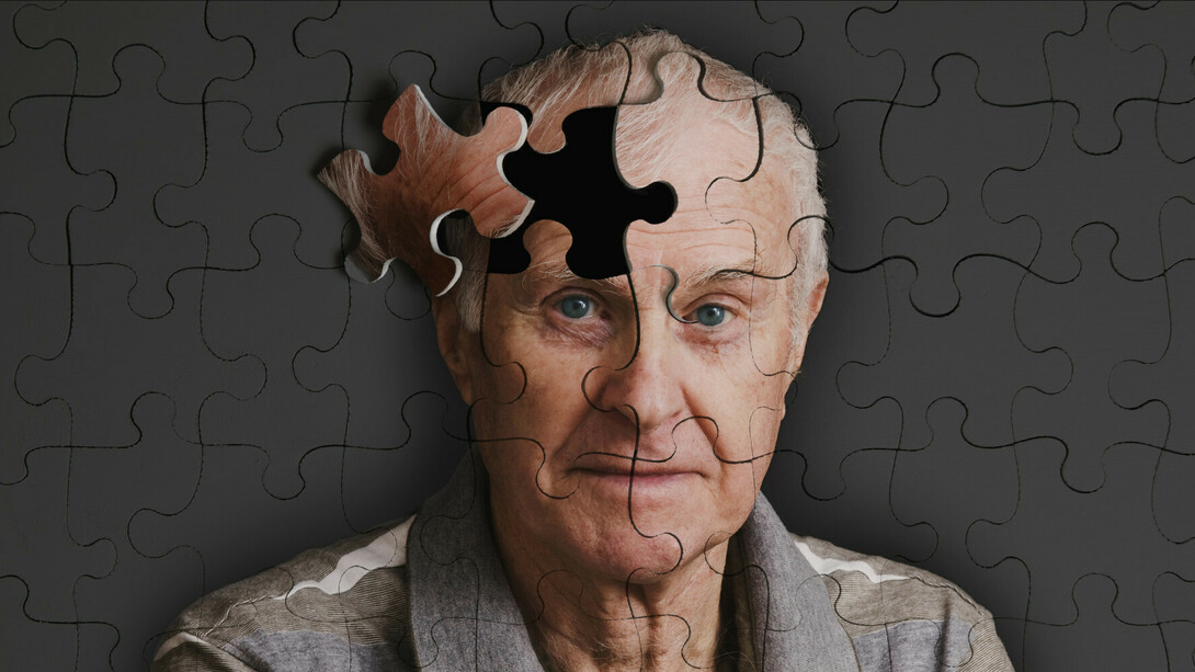 Neurodegenerativa e Incurable, el alzhéimer es una de las enfermedades más terribles que existen