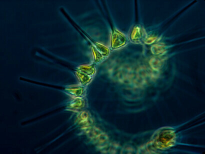 Visão microscópica do fitoplâncton. Embora a ideia de que o fitoplâncton possa reverter o aquecimento global possa chegar às manchetes, isso é improvável