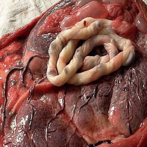 Candice Breitz. Courtesy of Kunstmuseum