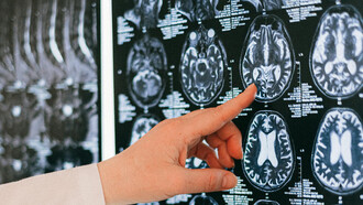 El sistema nervioso entérico y el microbioma intestinal ¡son tu segundo cerebro!
