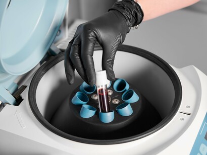 Centrifugation enables clinicians to extract platelet-rich plasma, the foundation of this regenerative therapy