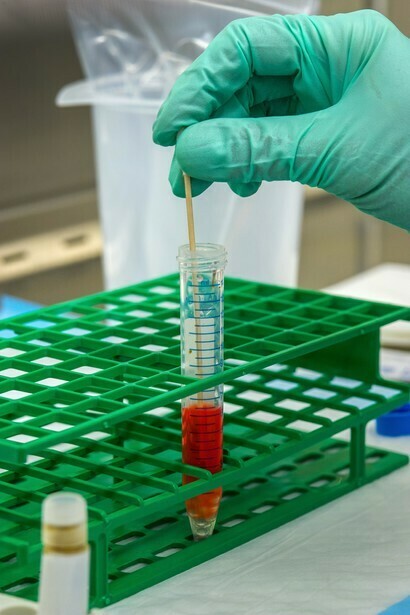 Der Impfstoff von Pfizer muss bei -75 ° C gelagert werden
