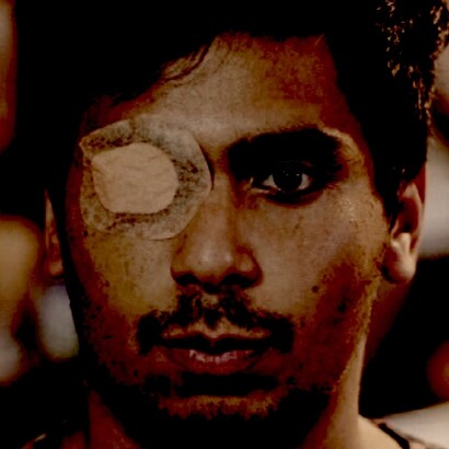 Tuerto para toda la vida por salir a protestar