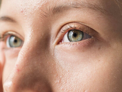 Un error de diagnóstico frecuente es confundir un ojo seco con obstrucción de la vía lagrimal y recomendar una cirugía innecesaria