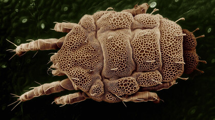 Ácaro del polvo ampliado bajo el microscopio