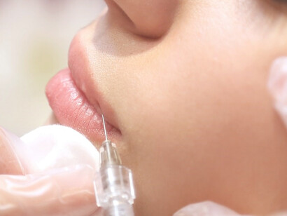A woman undergoing a Botox injection procedure administered by a certified medical practitioner
