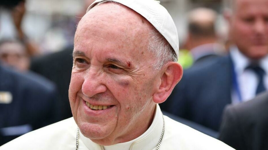 El papa, con el rostro magullado tras golpearse contra el cristal del papamóvil mientras recorría el barrio de San Francisco, en Cartagena