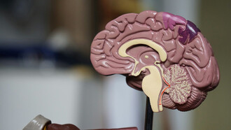 High-protein and high-fat diets play a crucial role in stroke recovery, acting as a brain sculptor for improved healing and rehabilitation