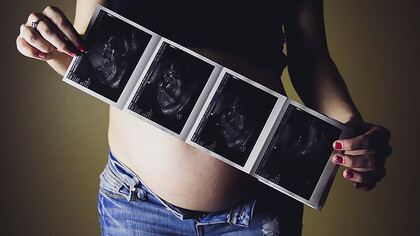 A teenage mother holding her ultrasound results, with a photo of her baby bump, reflecting the challenges of teenage pregnancy