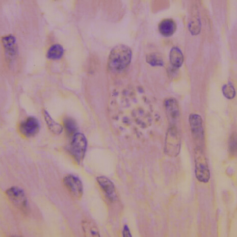 «Trypanosoma cruzi» en el corazón de un mono