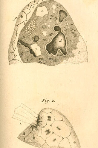 Ilustraciones de «De la auscultación mediata»