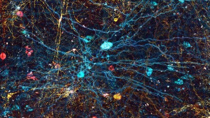 Le neurotecnologie sono dispositivi in grado di registrare, decodificare e/o modificare l’attività del cervello