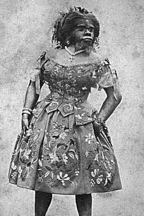 Julia Pastrana (1834-1860)