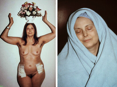 Hannah Wilke. Intra Venus