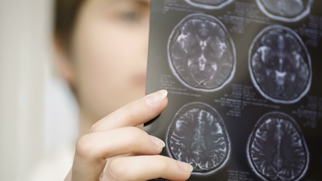 Una doctora observa un escáner cerebral