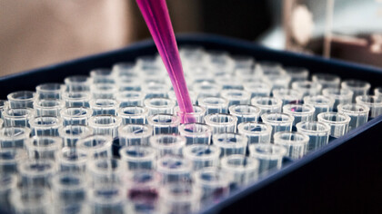 Dieses neue Krebsmedikament ist wichtig auf dem Gebiet der Immuntherapie