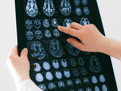 La relación entre tecnología y medicina podría traer grandes avences para tratamientos sobre movilidad