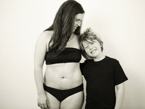 La obesidad postparto es de las menos conocidas