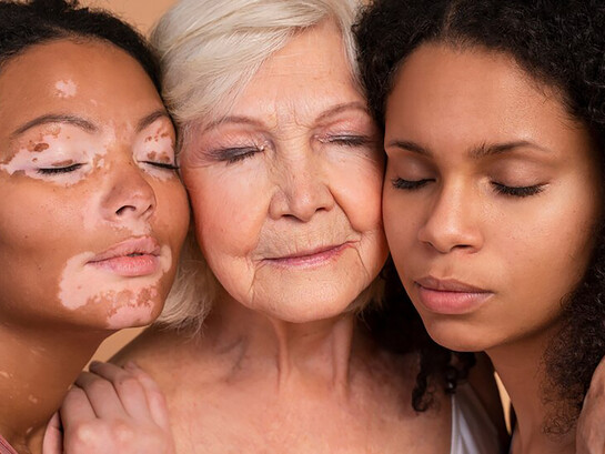 Women of different ages and diverse skin types posing together, celebrating natural beauty and individuality