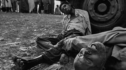 James Nachtwey. Víctimas de la guerra en África