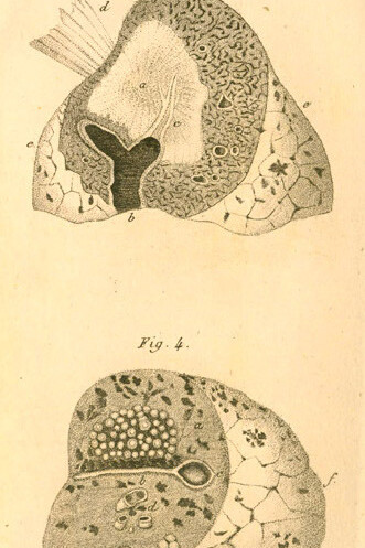 Ilustraciones de «De la auscultación mediata»