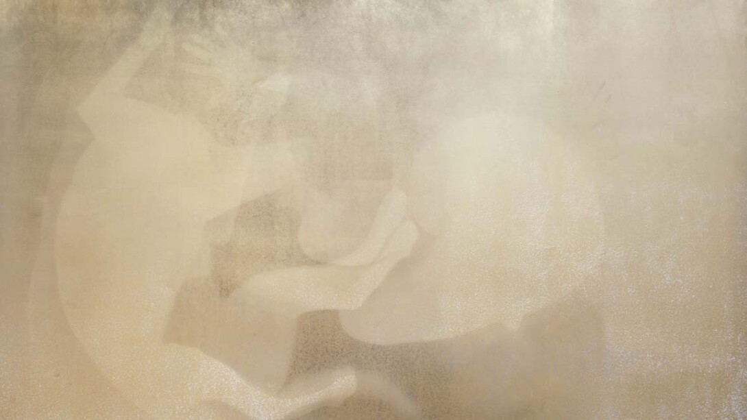 Márcia Xavier, Mandragora ouro (detalhe), 2026. Cortesia da Galeria 111