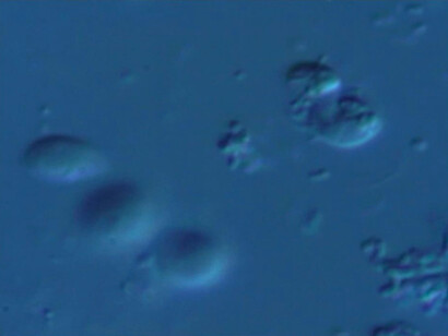Provora al microscopio ingrandimento